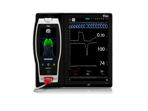 Masimo Root®搭配ORi™（照片：美國商業資訊） 