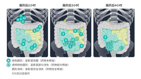 D23布地奈德回肠靶向片显影示意图 (图示：美国商业资讯) 